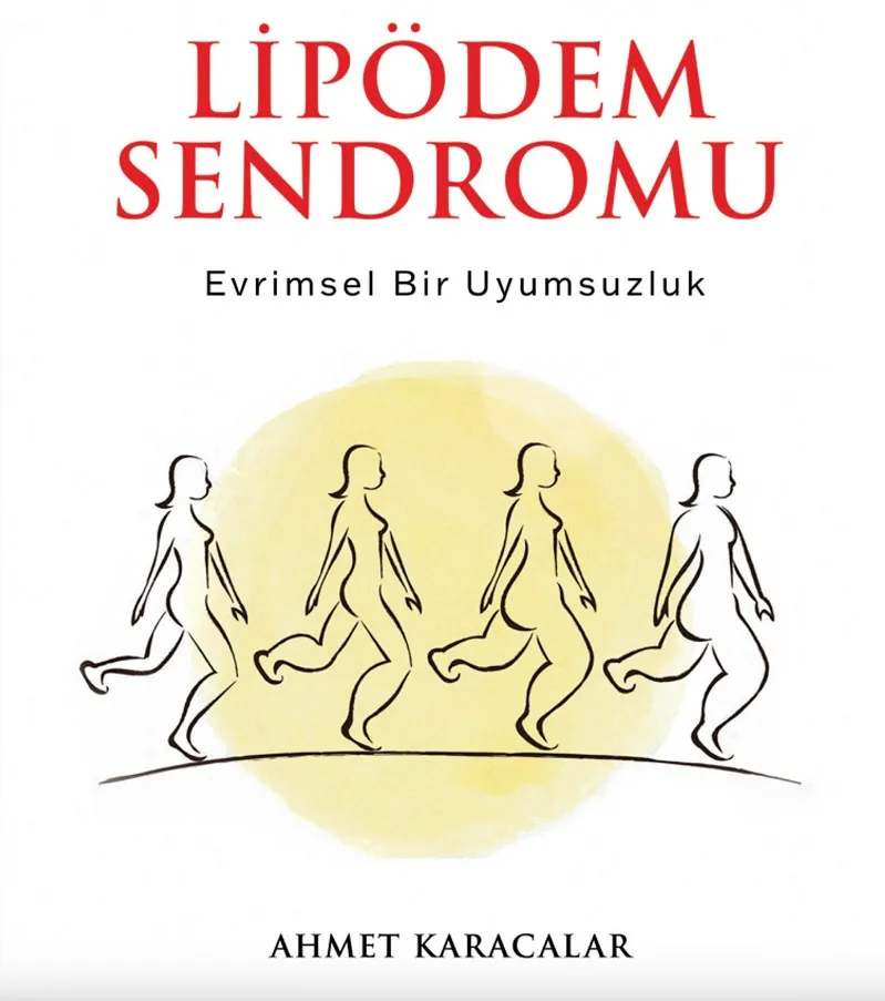 NEOLİTİK DÖNEMDEN GÜNÜMÜZE ULAŞAN EVRİMSEL BİR HASTALIK: LİPÖDEM…